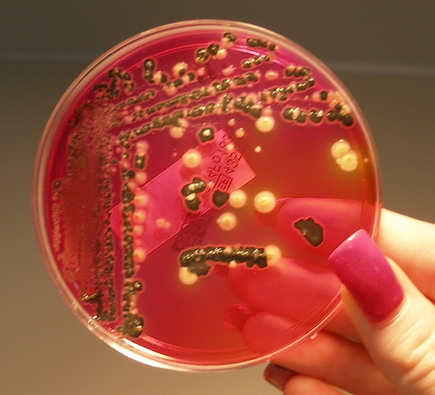 Bacteria in a Dish